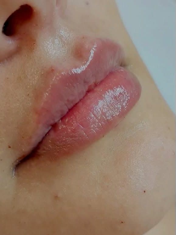 Lábios com resultado natural